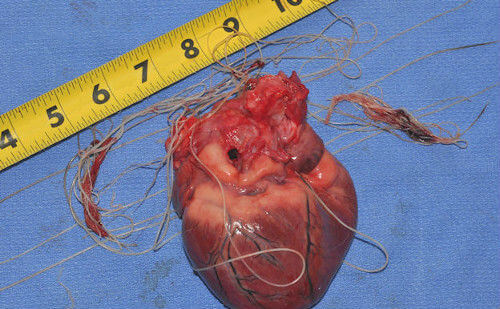 паразиты сердца